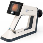 Topcon Signal Handheld Retinal Camera
